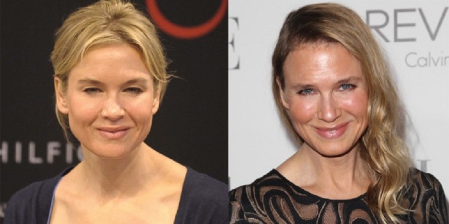 Renee Zellweger