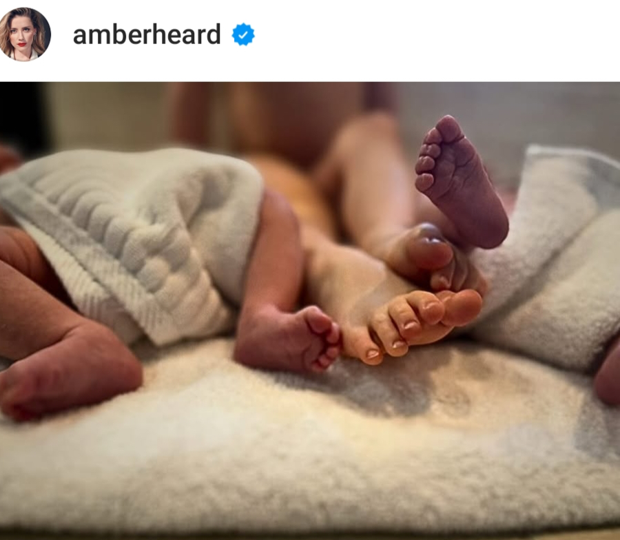 Amber Heard Twins